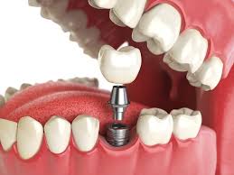 Oral Surgery