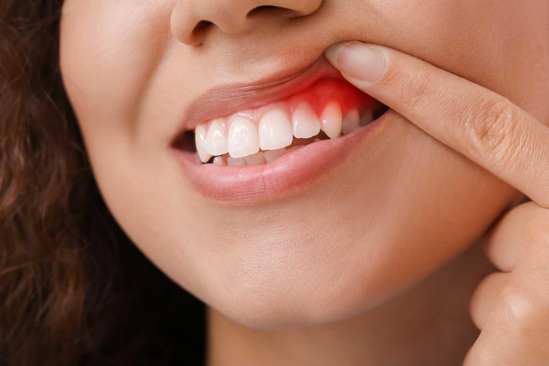 Periodontics